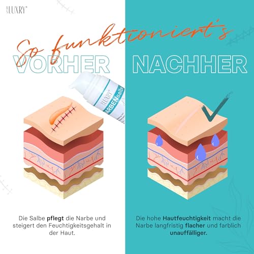 BS Luxry® Premium Narbengel für Kinder & Erwachsene – 30 g Silikongel zur Pflege von Narben & Dehnungsstreifen – Pflegt die Haut intensiv & sorgt für ein geschmeidiges, ebenmäßiges Hautbild