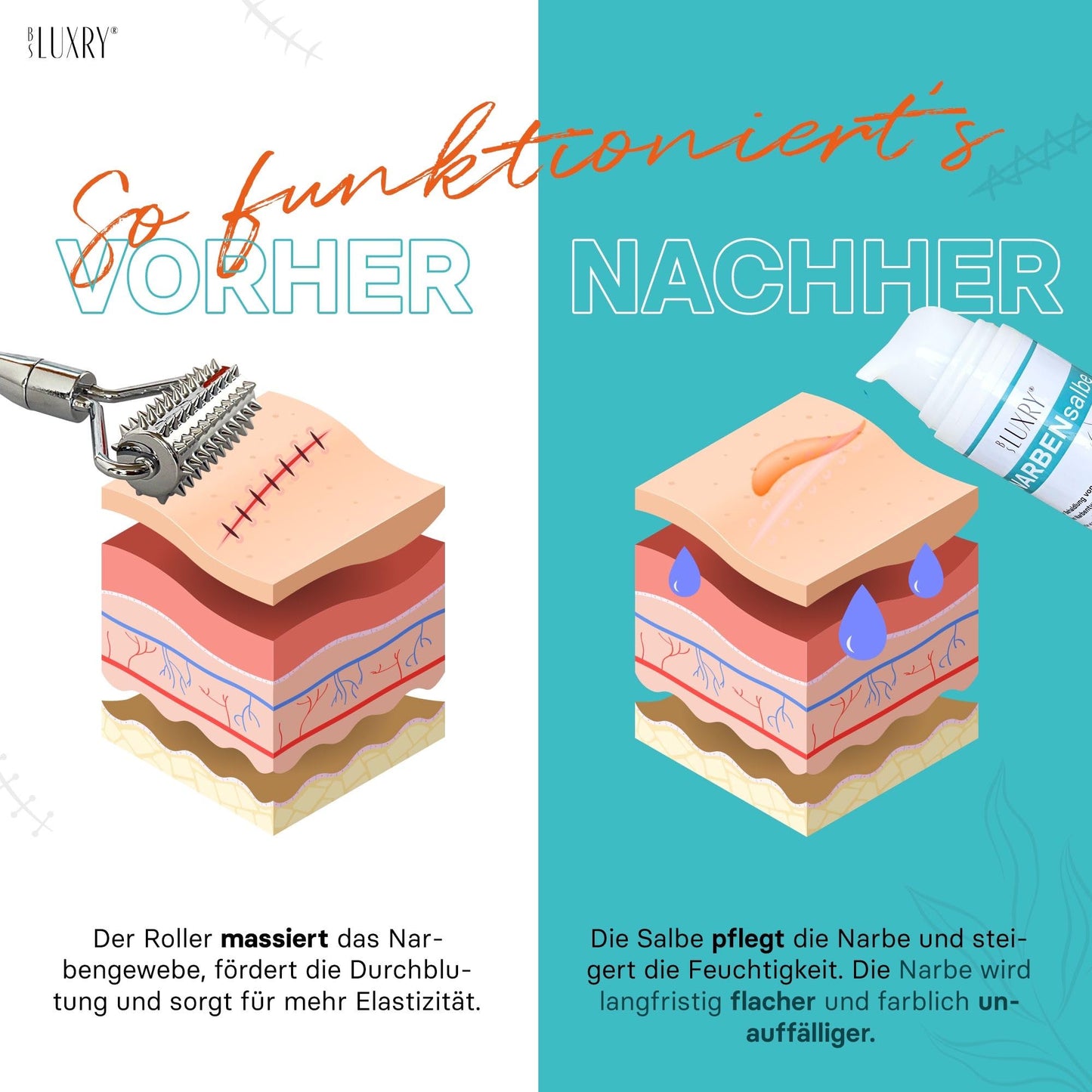 BS Luxry® Narbenpflege-Set – 30 g Narbensalbe & kühlbarer Narbenroller – 3-fach Pflegewirkung zur intensiven Narbenpflege & Hautglättung – Für Narben, Dehnungsstreifen & empfindliche Haut