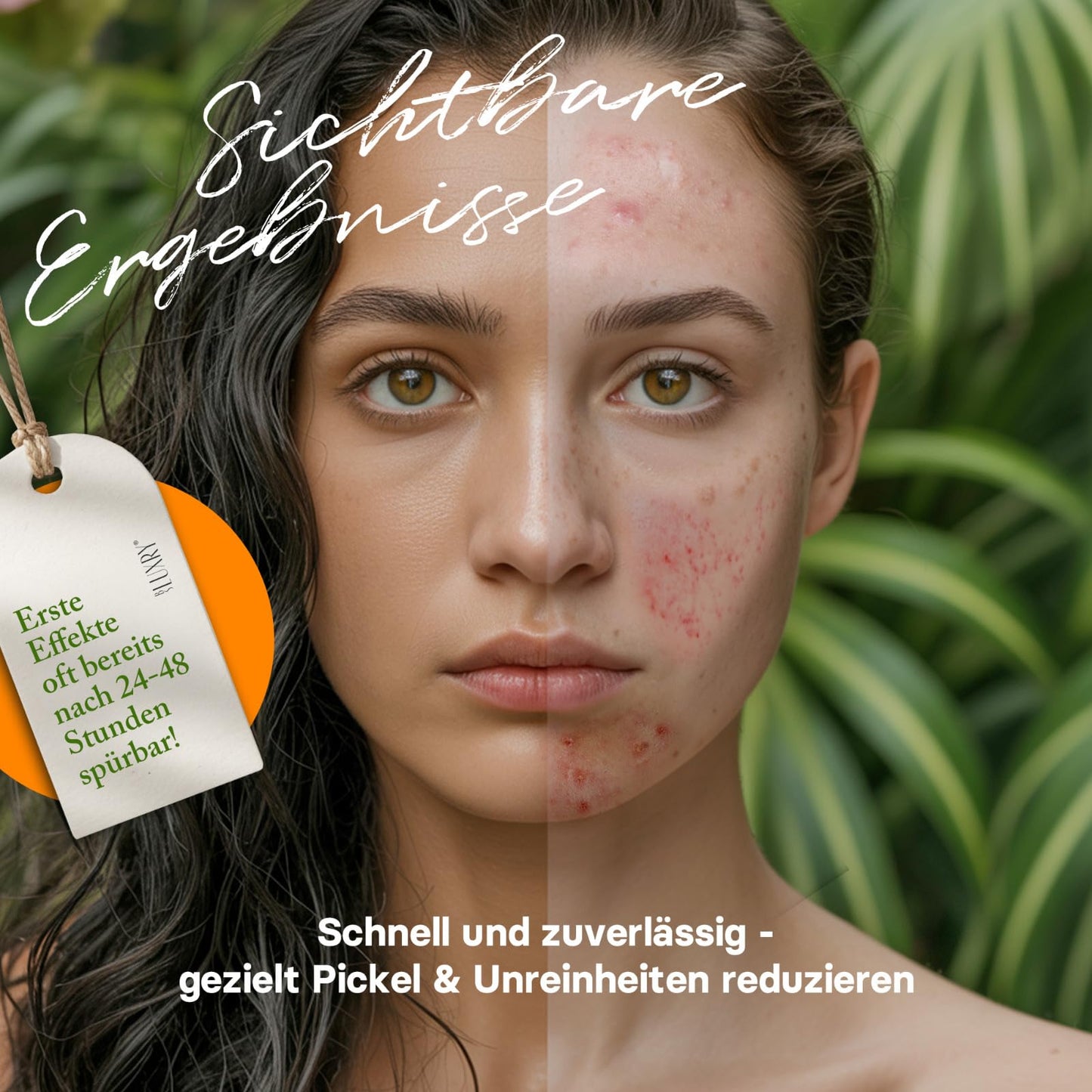 BS Luxry® Zinksalbe gegen Pickel & Akne – 50ml – mit Zinkoxid, Teebaumöl, Salicylsäure, Lavendel & Sheabutter – bei unreiner Haut, Mitessern- reduziert sichtbare Poren & Rosacea
