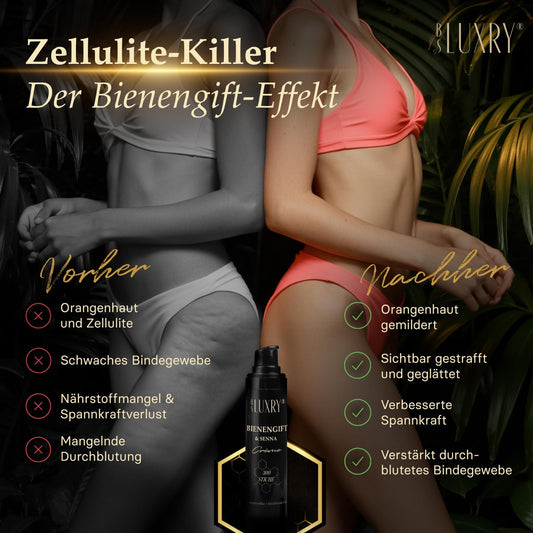 BS Luxry® Bienengift & Senna Creme 100 ml – Bienengiftsalbe gegen Besenreiser, Cellulite, Arthrose & Krampfadern – Pflege für empfindliche Haut & Bindegewebe – 300 Bienenstiche Wirkstoffkomplex