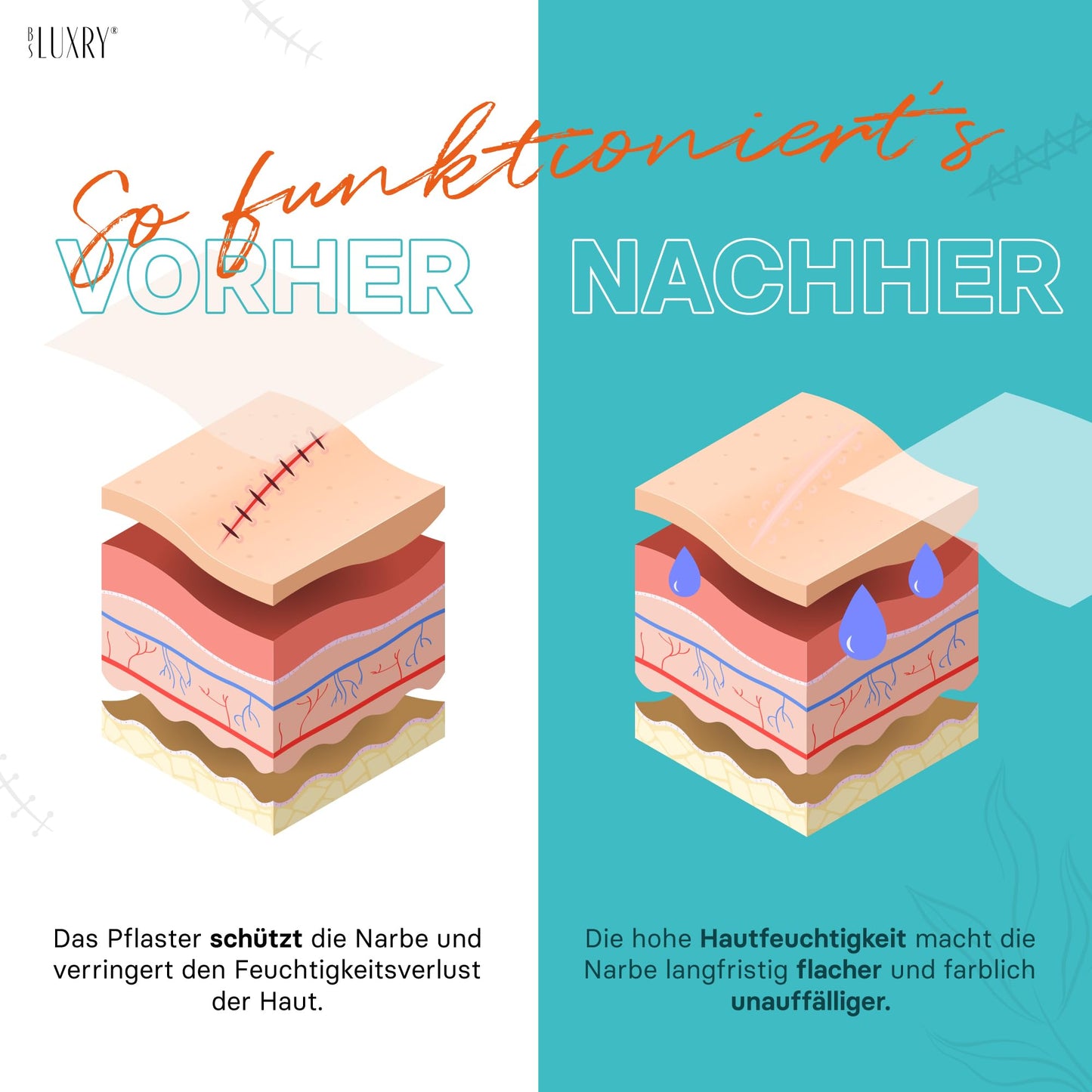 BS Luxry® Narbenpflaster 300 cm – Testsieger (Note 1,2) – Wiederverwendbares Silikonpflaster zur sichtbaren Narbenreduktion bei Kaiserschnitt, OP, Verbrennung, Keloid & Akne – UV-beständig Marke: BS Luxry