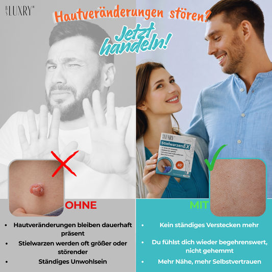 BS Luxry® StielwarzenEX – Stielwarzen & Hautanhängsel entfernen für Zuhause – Skin Tag Remover – Warentest-Sieger 1,2 – Sicher & Effektiv – Für Hals, Achseln, Rücken & Körper